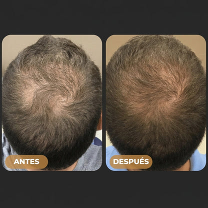 TROYA™ Activador de Raíces — Shampoo anticaída para hombres: ¡recuperá tu cabello con solo 4 lavados por semana!