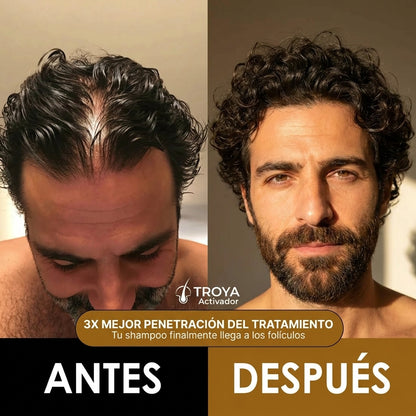 TROYA™ Activador de Raíces — Shampoo anticaída para hombres: ¡recuperá tu cabello con solo 4 lavados por semana!
